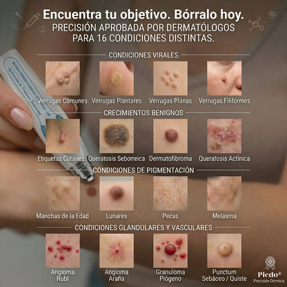 𝐏𝐢𝐜𝐝𝐨® 🍇🍇 Borrador de Verrugas y Manchas en 7 Días (𝐀𝐩𝐥𝐢𝐜𝐚𝐝𝐨𝐫 𝐫𝐨𝐥𝐥-𝐨𝐧: 𝐬𝐢𝐧 𝐝𝐨𝐥𝐨𝐫 𝐧𝐢 𝐜𝐢𝐜𝐚𝐭𝐫𝐢𝐜𝐞𝐬)✨